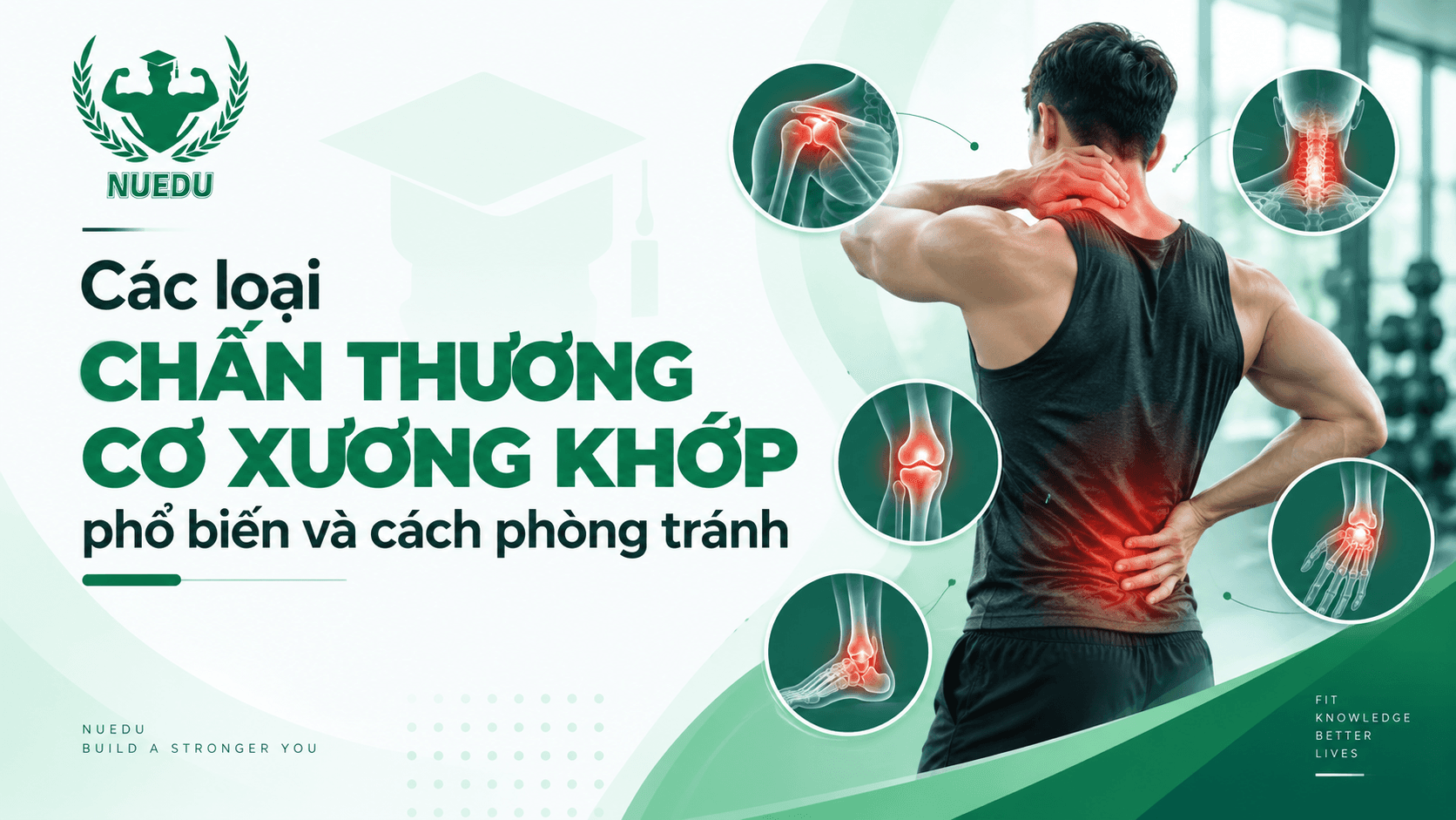 Các loại chấn thương cơ xương khớp phổ biến và cách phòng tránh